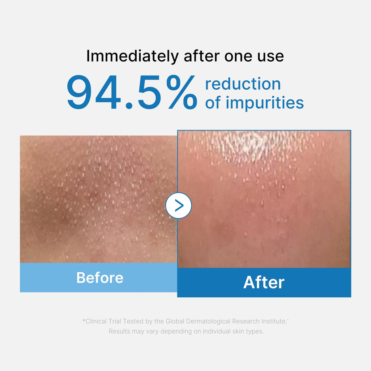 Medicube Zero Pore Blackhead Deep Cleansing — Aceite Limpiador 205 ml — foto oficial de la marca