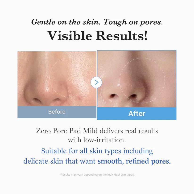 Medicube Zero Pore Pad Mild — Discos exfoliantes suaves 70 unidades