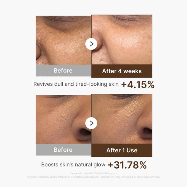Medicube Deep Vita C Capsule Serum — Sérum facial 30 ml